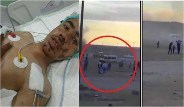 مؤثر…هذا ما قاله الطفل الذي “دُهس” بجرادة في أول خروج إعلامي (فيديو)