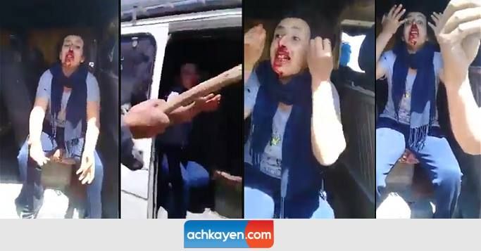 خطير..ملثمون يعتدون بوحشية على رجل وامرأة بعد محاصرتهما في الخلاء (فيديو)