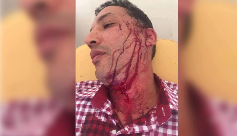 الوزارة تُلزم “أستاذ مريرت” بعدم التنازل بعد تعرضه للتشرميل (صور)