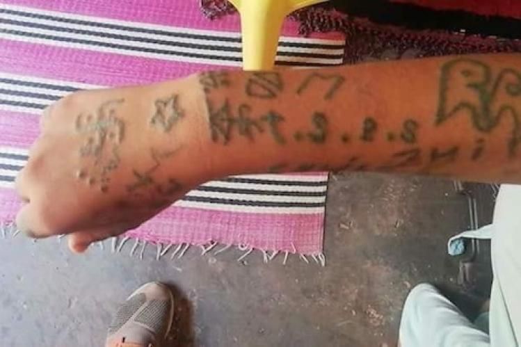 بسبب ضحية الوشم..رحيل لجنة وزارة الصحة بعد مشاداة مع حقوقيين