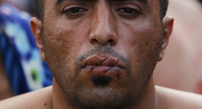 مغربي يخيط فمه إحتجاجا على طرده من منزله بفرنسا