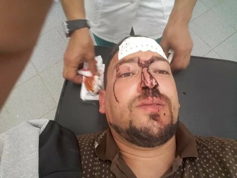 حقوقيون يطالبون بالتحقيق مع قائد عنف مواطن
