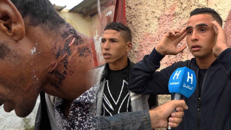 بالفيديو..ضحية لـ”قاطع الرأس” بالمحمدية يحكي تفاصيل الجريمة