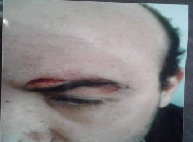 اعتداء شنيع على أستاذ من طرف تلميذه بالقنيطرة