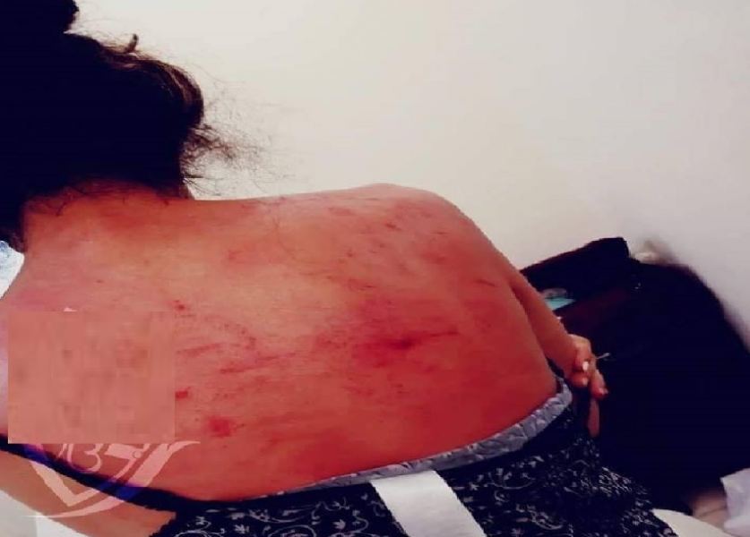 الخارجية تدخل على خط المغربية المعنفة من طرف زوجها السعودي