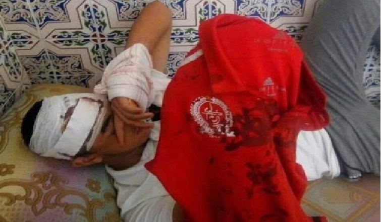 اعتداءات شنيعة على جمهور الكوكب تشعل الفايسبوك والأمن يفتح تحقيقا (صور)