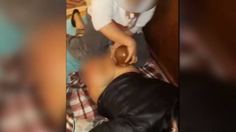 فيديو لعملية تكبير المؤخرة بطريقة تقليدية يشعل الفيسبوك