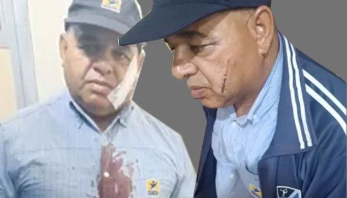 تفاصيل جديدة في حادث الاعتدء على ساعي البريد في فاس