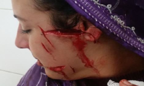 زوج يشرمل زوجته بعد رفضها زواجه الثاني