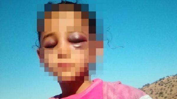 السجن النافذ لأستاذ تارودانت المتهم بتعنيف تلميذته