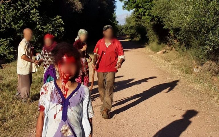 أم تتهم جارها بمحاولة اغتصاب طفلتها وتعنيفها