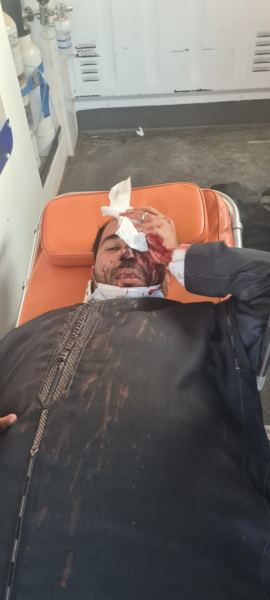 الصويرة .. منتخبون “يشرملون” منافسهم بسبب انتخابات الغرف المهنية (صور)