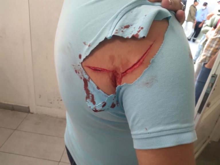 ولاية أمن طنجة تكشف حقيقة تعرض مراقبين بمكتب للتصويت للاعتداء بالسلاح الأبيض