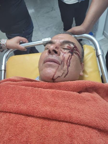 رحاب: عصابة تابعة لرئيس جماعة بامي تعتدي بالسلاح الأبيض على برلماني اتحادي