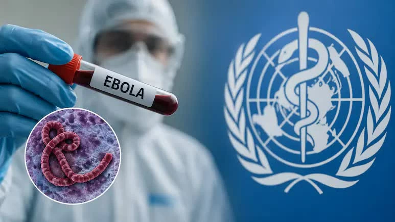 238 وفاة وارتفاع مقلق للإصابات بـ”إيبولا”