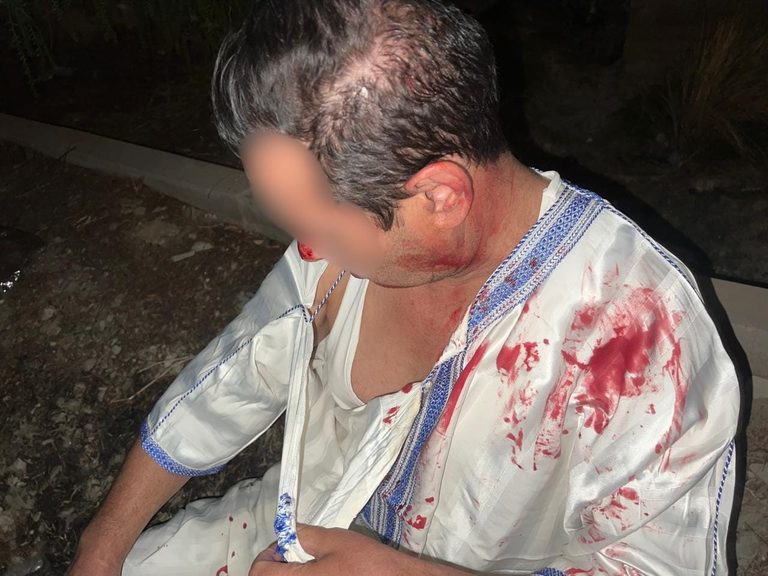 اعتداء يرسل مستثمرا معروفا في تامنصورت إلى المستعجلات